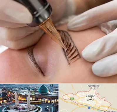 میکروبلیدینگ در زنجان