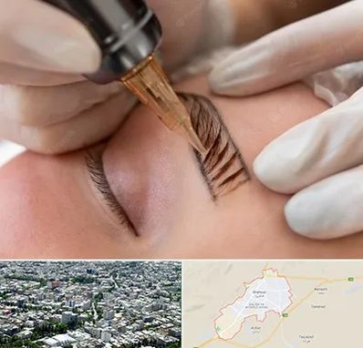 میکروبلیدینگ در شاهرود