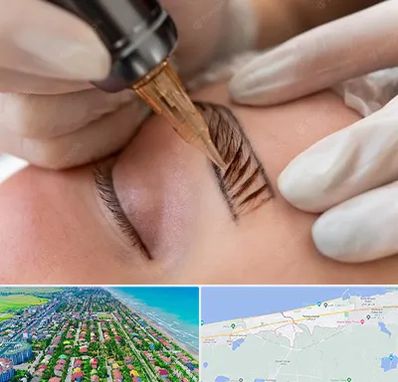 میکروبلیدینگ در فریدونکنار