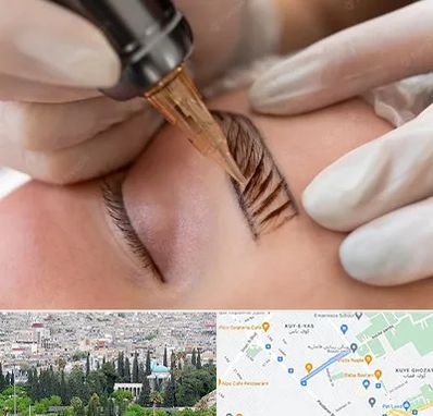 میکروبلیدینگ در محلاتی شیراز