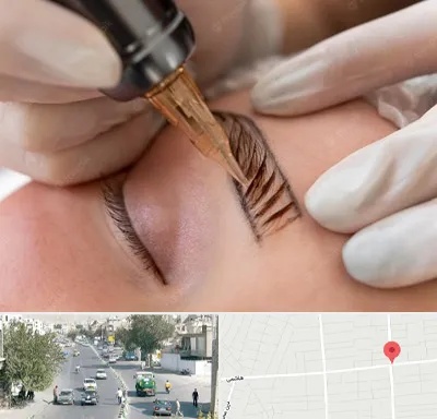 میکروبلیدینگ در هاشمی