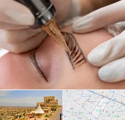 میکروبلیدینگ در هاشمیه مشهد