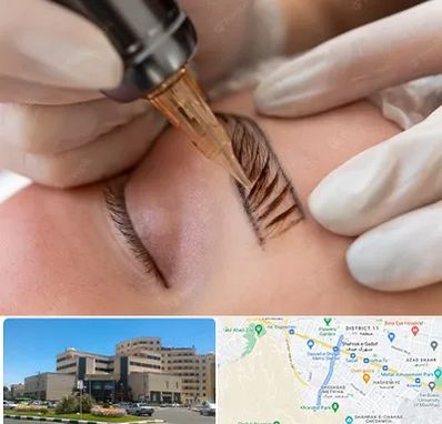 میکروبلیدینگ در صیاد شیرازی مشهد