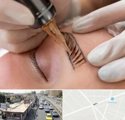 میکروبلیدینگ در خیابان دماوند