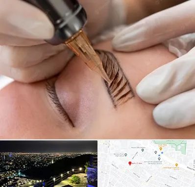 میکروبلیدینگ در هفت تیر مشهد