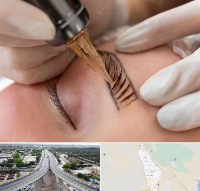 میکروبلیدینگ در اندیمشک