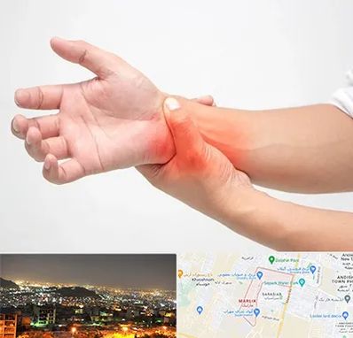 دکتر متخصص دست در مارلیک کرج 