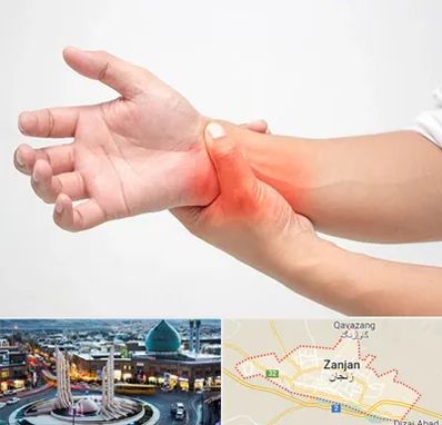 دکتر متخصص دست در زنجان