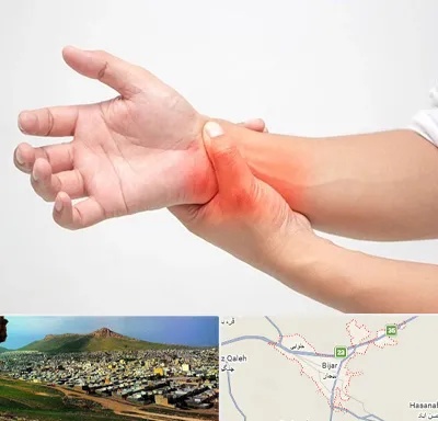 دکتر متخصص دست در بیجار