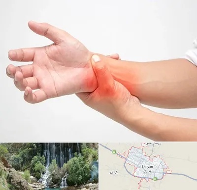 دکتر متخصص دست در شیروان