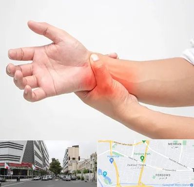 دکتر متخصص دست در بلوار فردوس 