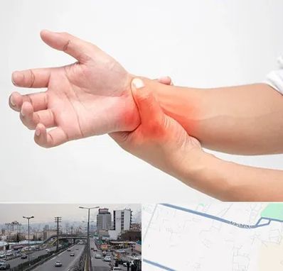 دکتر متخصص دست در بلوار ارتش