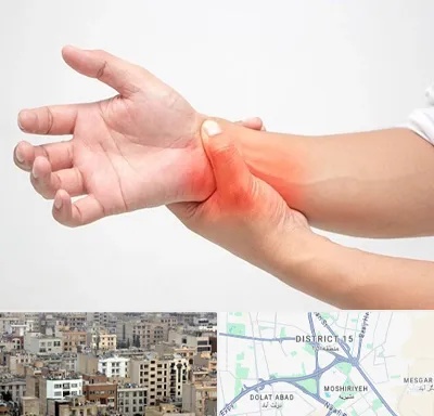 دکتر متخصص دست در جنوب شرق تهران