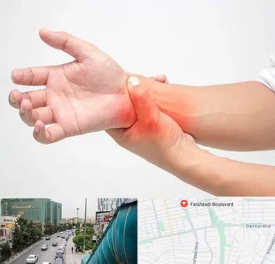 دکتر متخصص دست در بلوار فرحزادی