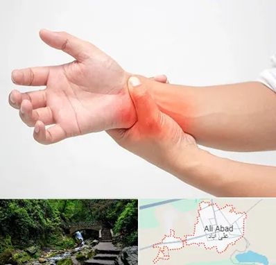 دکتر متخصص دست در علی‌ آباد کتول