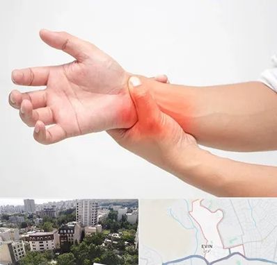 دکتر متخصص دست در اوین