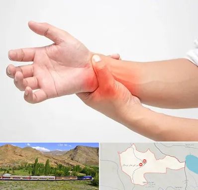 دکتر متخصص دست در خاش