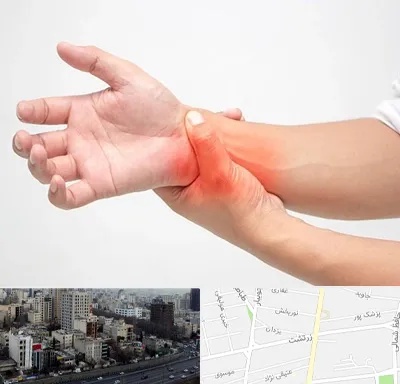 دکتر متخصص دست در زرتشت