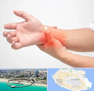 دکتر متخصص دست در کیش