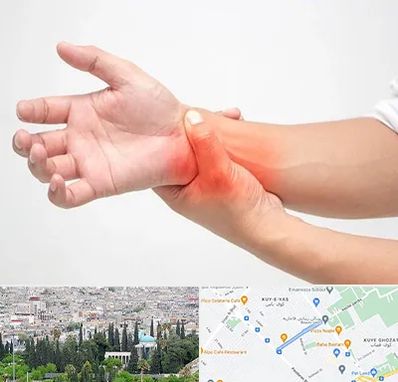 دکتر متخصص دست در محلاتی شیراز 