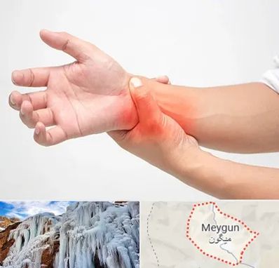 دکتر متخصص دست در میگون