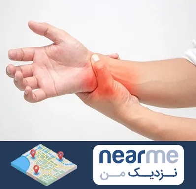 دکتر متخصص دست در نزدیک من