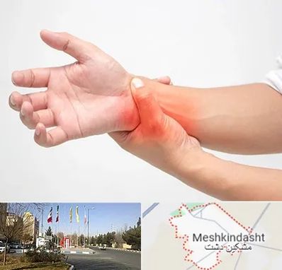 دکتر متخصص دست در مشکین دشت