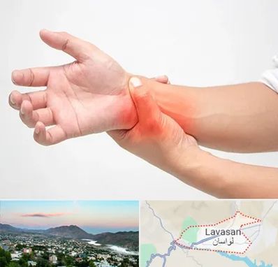 دکتر متخصص دست در لواسان