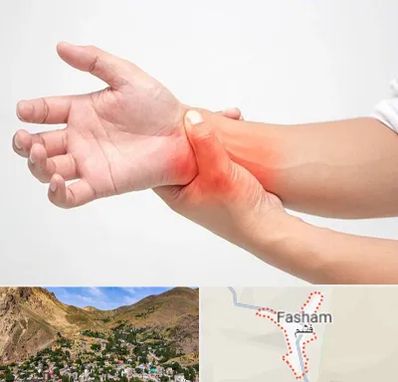 دکتر متخصص دست در فشم
