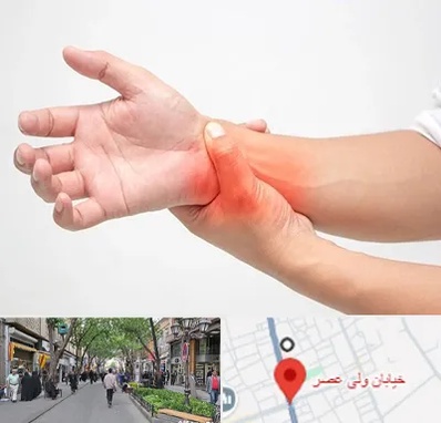 دکتر متخصص دست در ولیعصر شهریار