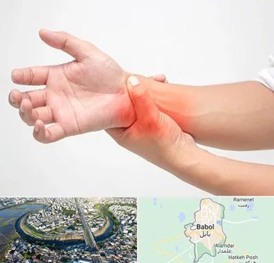 دکتر متخصص دست در بابل