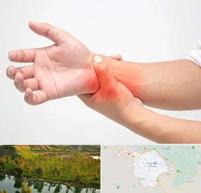 دکتر متخصص دست در بهبهان