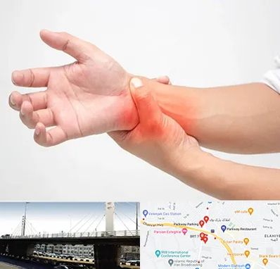 دکتر متخصص دست در پارک وی 