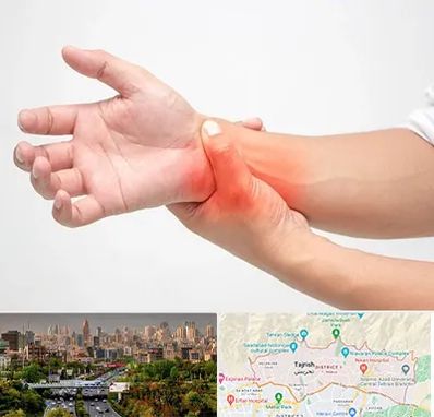 دکتر متخصص دست در منطقه 1 تهران 