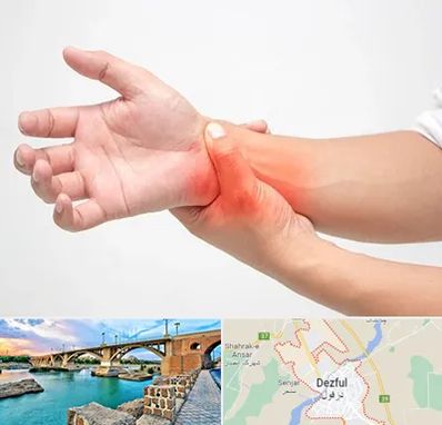 دکتر متخصص دست در دزفول