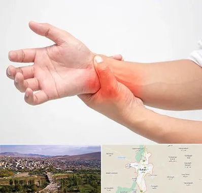 دکتر متخصص دست در بوکان