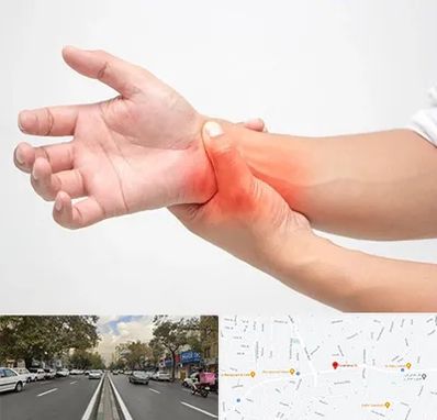 دکتر متخصص دست در دولت 