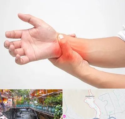 دکتر متخصص دست در درکه