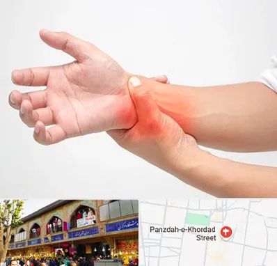 دکتر متخصص دست در 15 خرداد