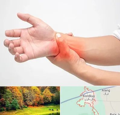 دکتر متخصص دست در کردکوی