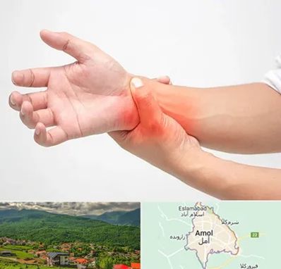 دکتر متخصص دست در آمل