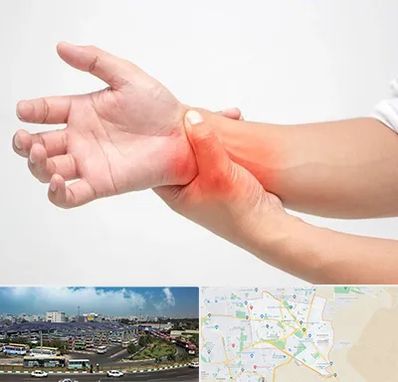 دکتر متخصص دست در منطقه 15 تهران