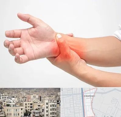 دکتر متخصص دست در اسکندری