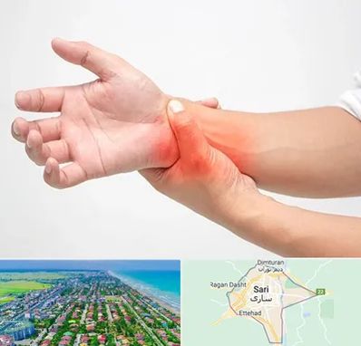 دکتر متخصص دست در ساری