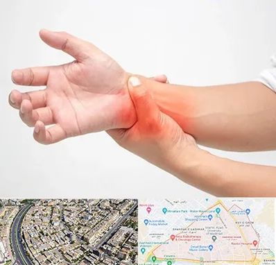 دکتر متخصص دست در شهرک غرب مشهد 