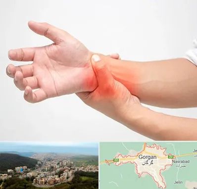 دکتر متخصص دست در گرگان
