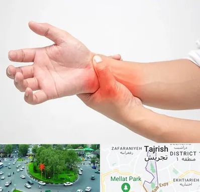 دکتر متخصص دست در تجریش 