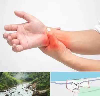 دکتر متخصص دست در رویان