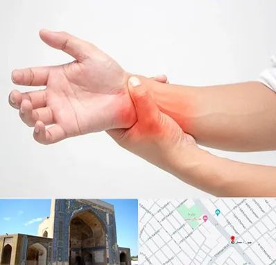 دکتر متخصص دست در مصلی مشهد