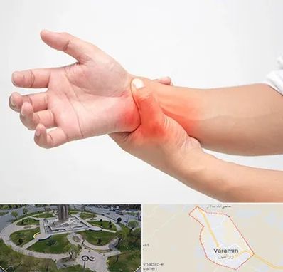 دکتر متخصص دست در ورامین